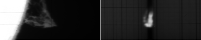 Frame